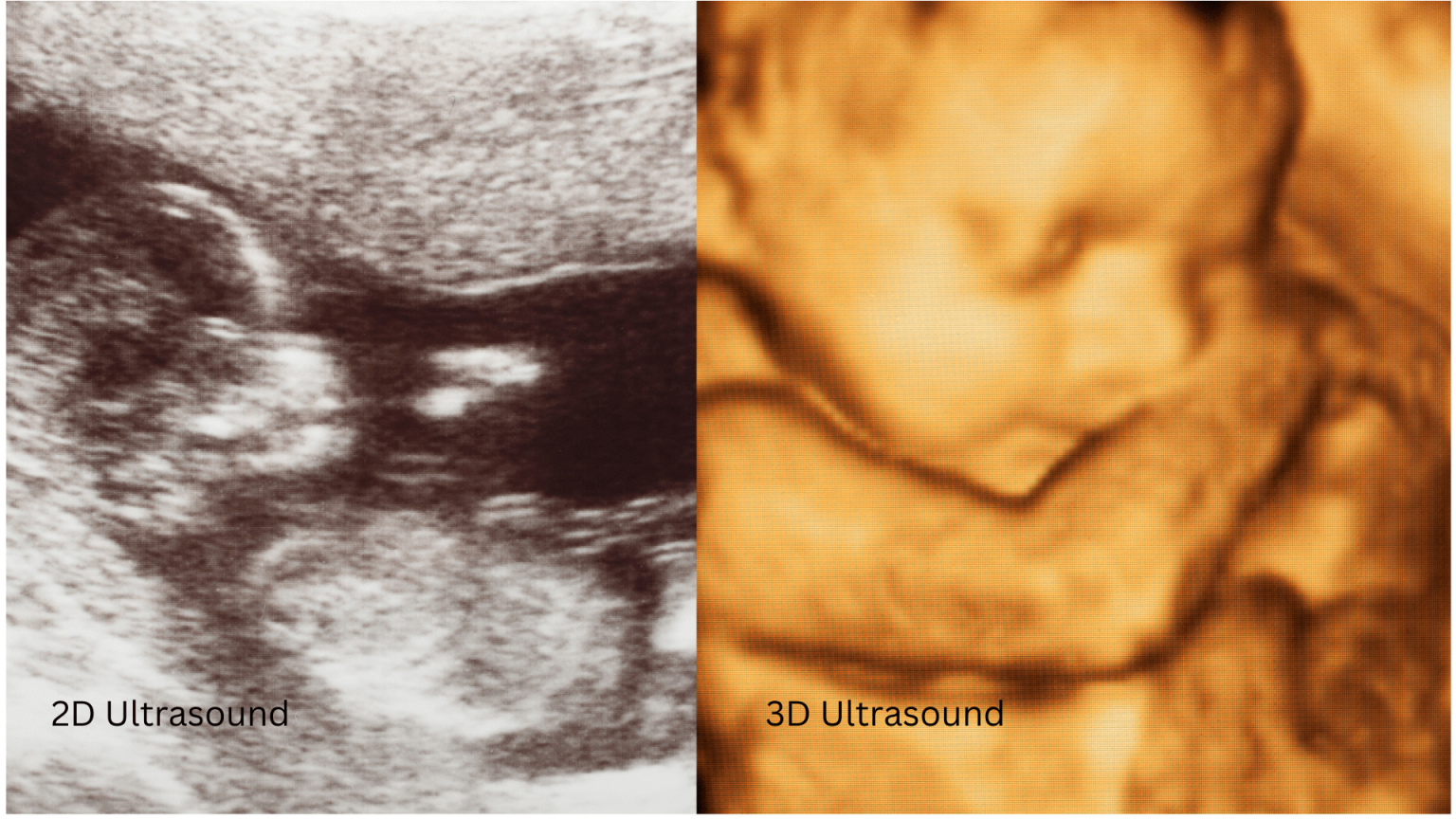What Is a 3D Ultrasound and How It Works | Expert Guide
